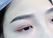 鱼骨轻推 鱼骨轻推